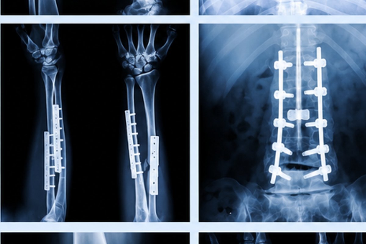Joint Replacement & Orthopaedic Surgery