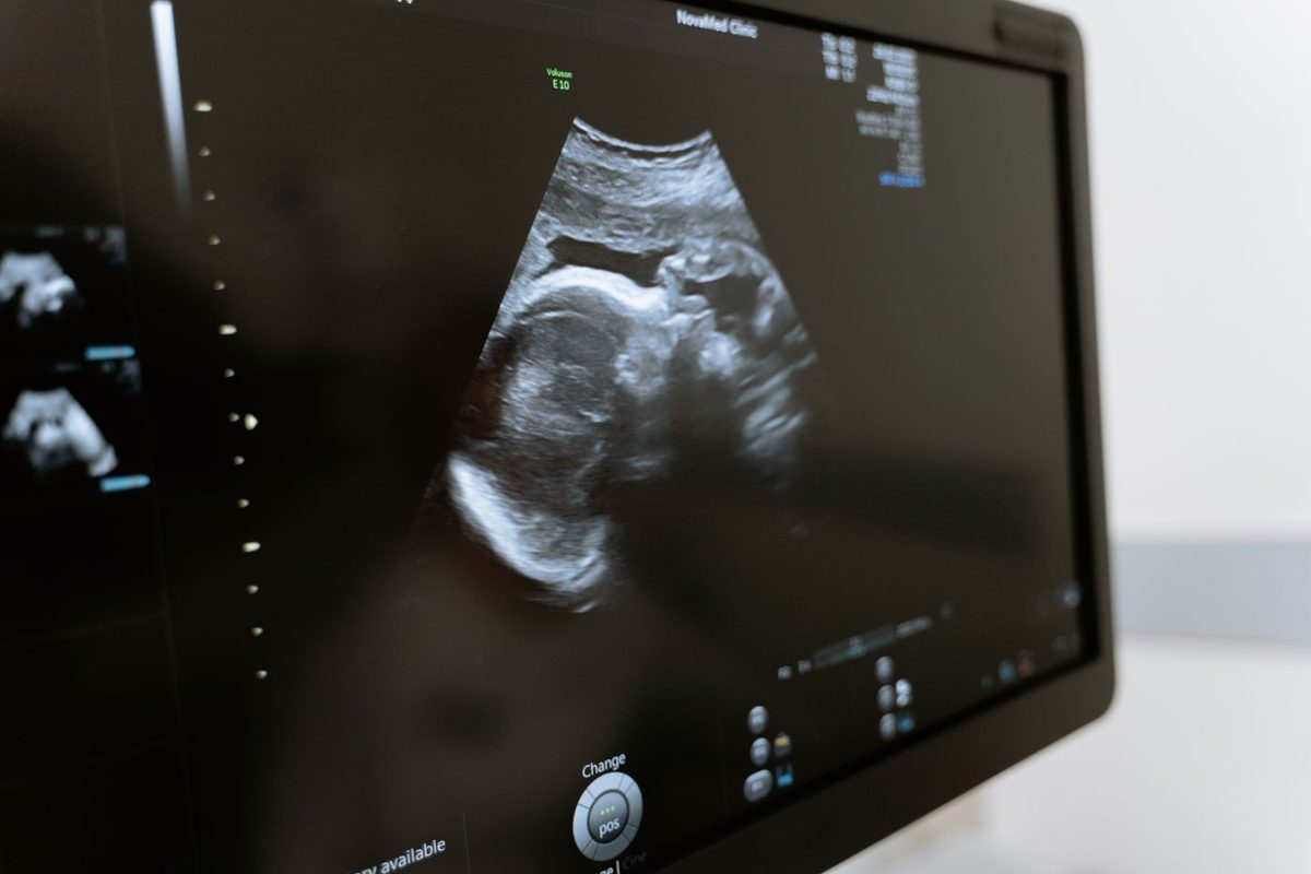 Ultrasound & ECHO